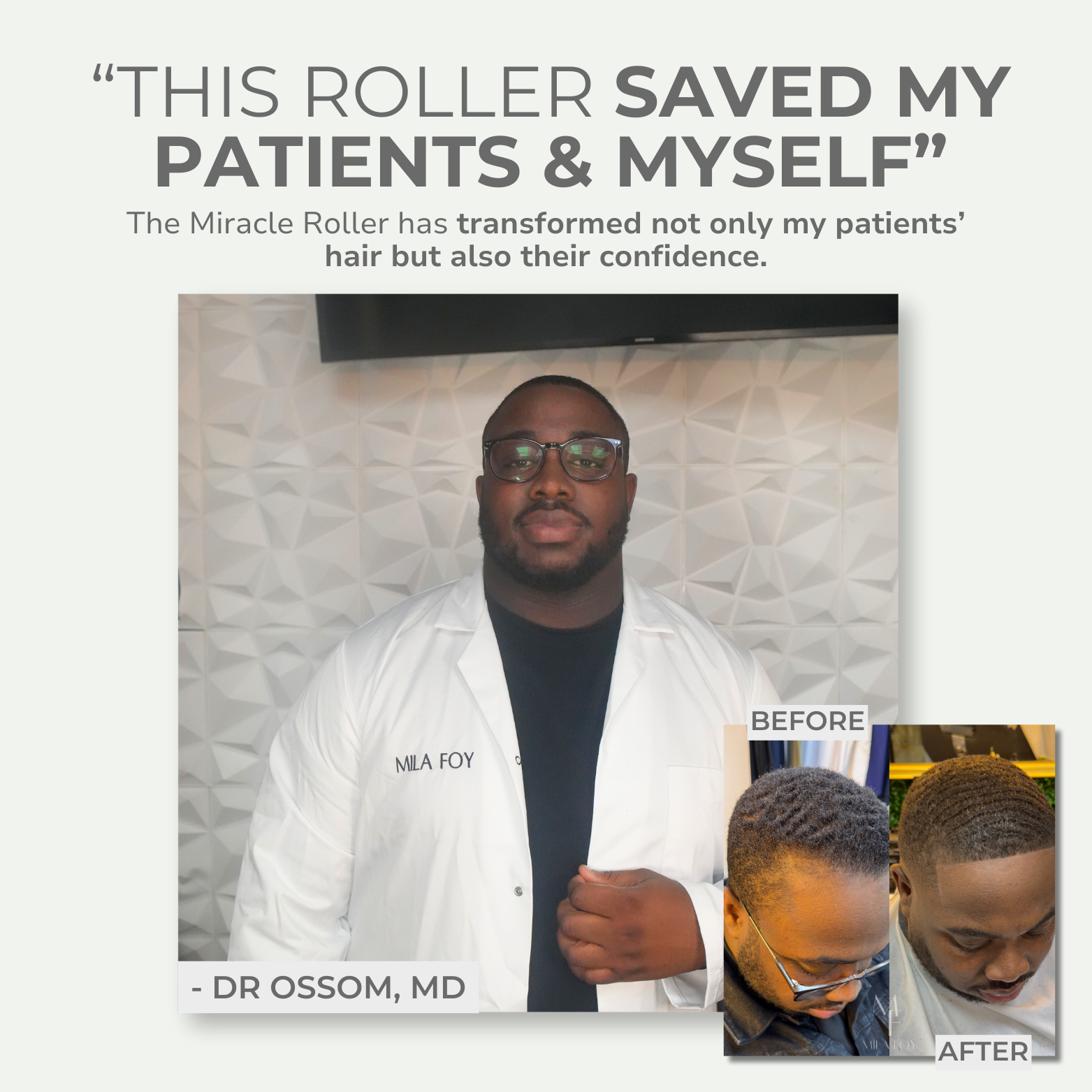 Miracle Roller™ (Rapid Hair Growth)