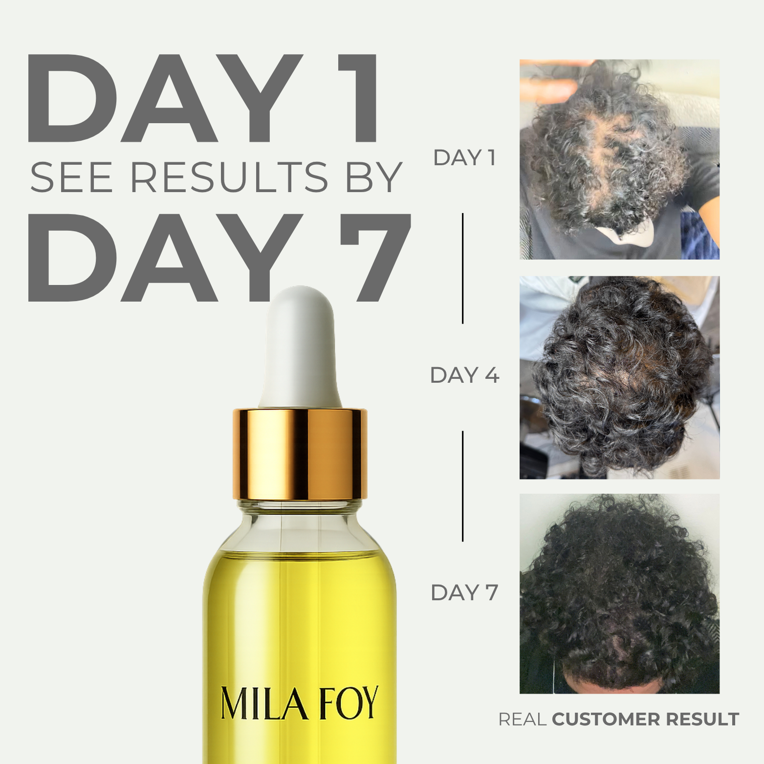 Hair Growth & Cleaning Kit™ - Mila Foy