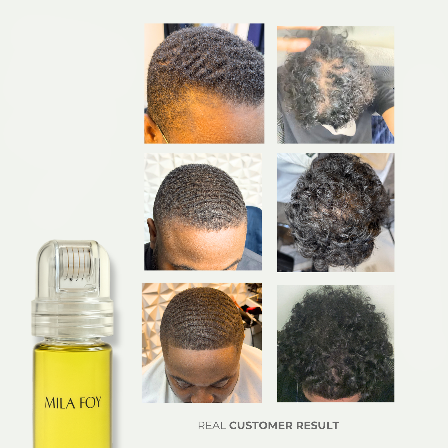 Rapid Hair Growth System™ - Mila Foy