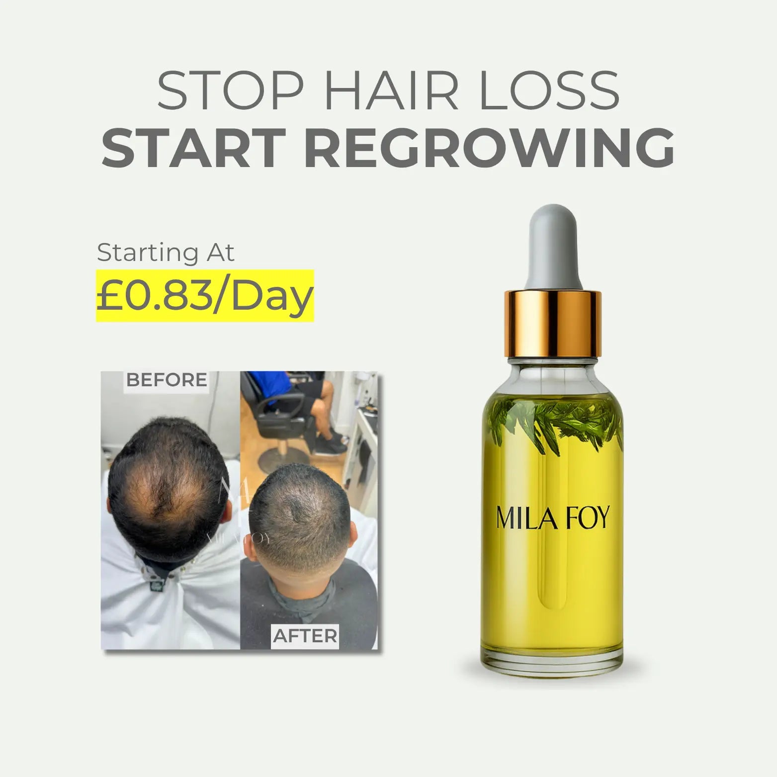 Hair Growth & Cleaning Kit™ - Mila Foy