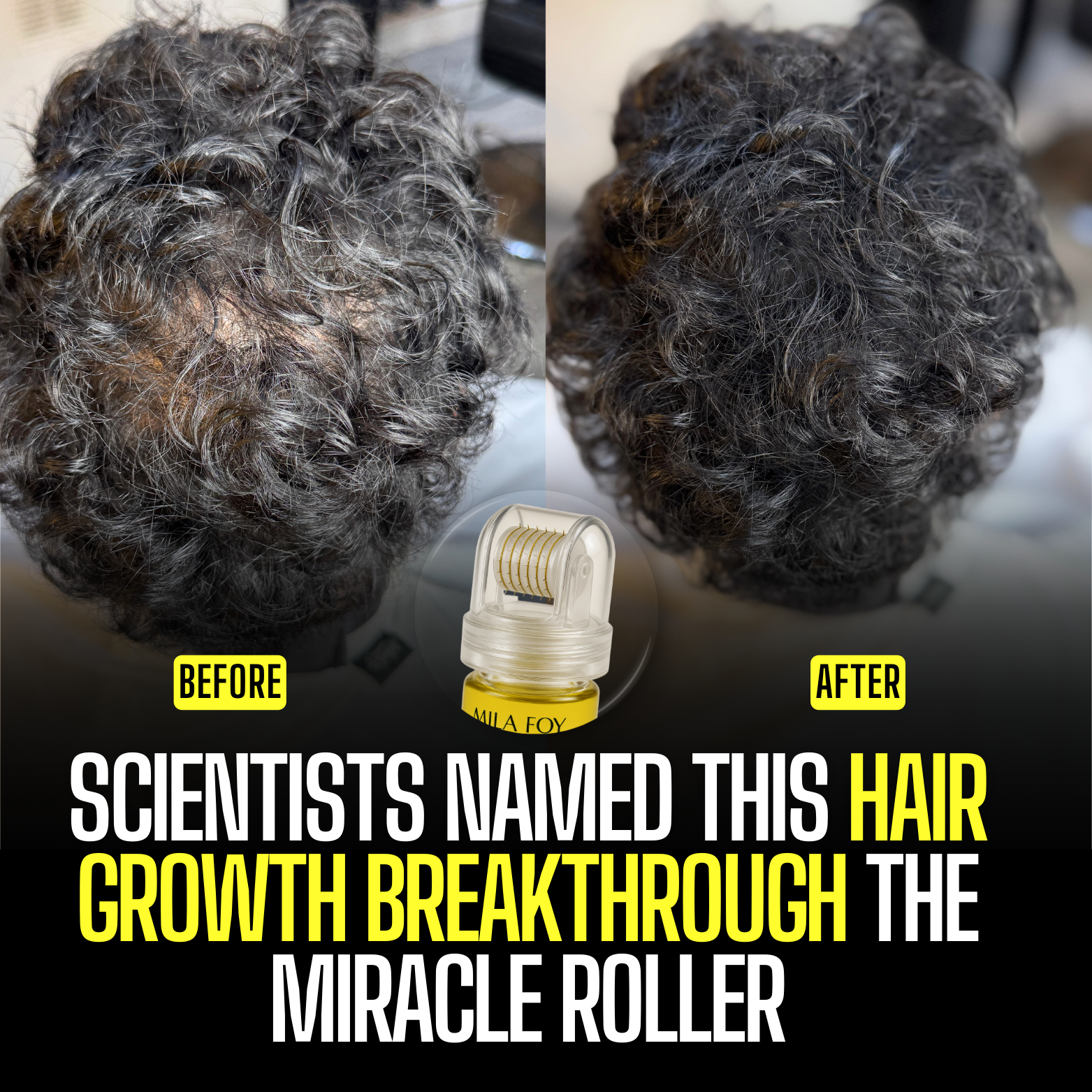 Miracle Roller