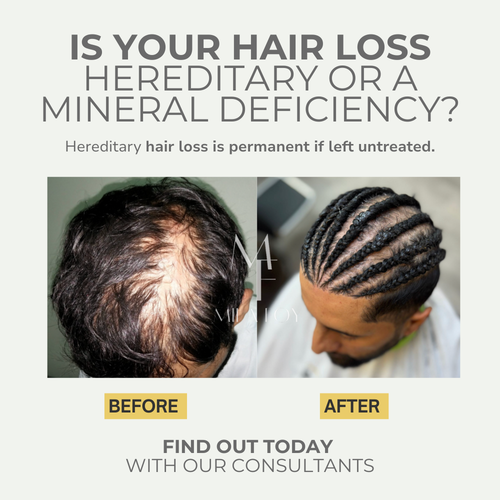 Advanced Hair Loss Diagnosis™ (Virtual)
