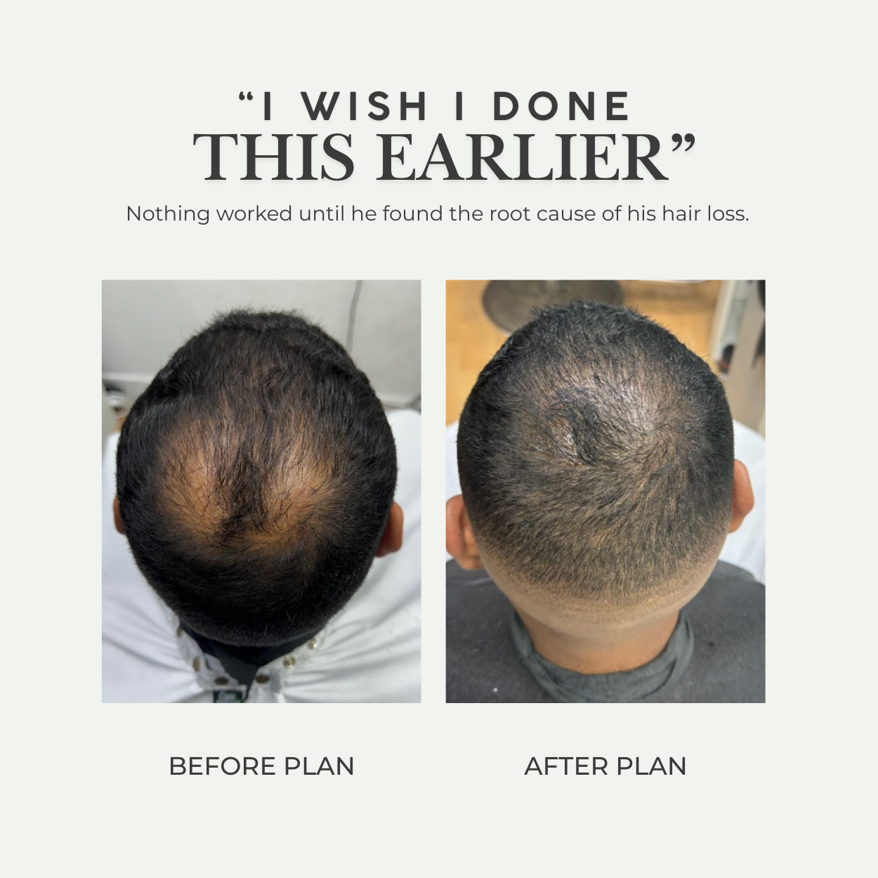 Hair Loss Diagnosis + Tailored Treatment