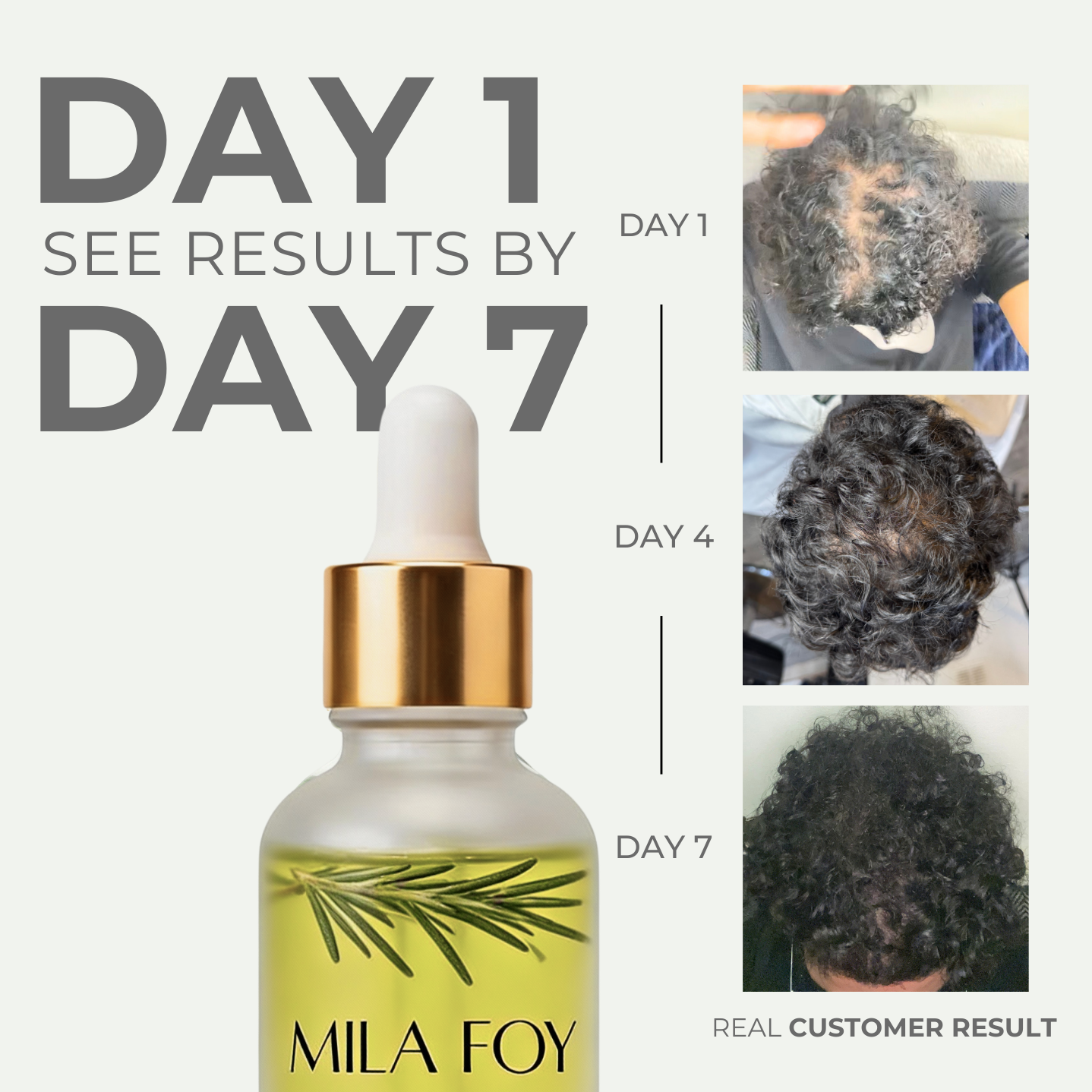 Hair Follicle Stimulator™ - Mila Foy