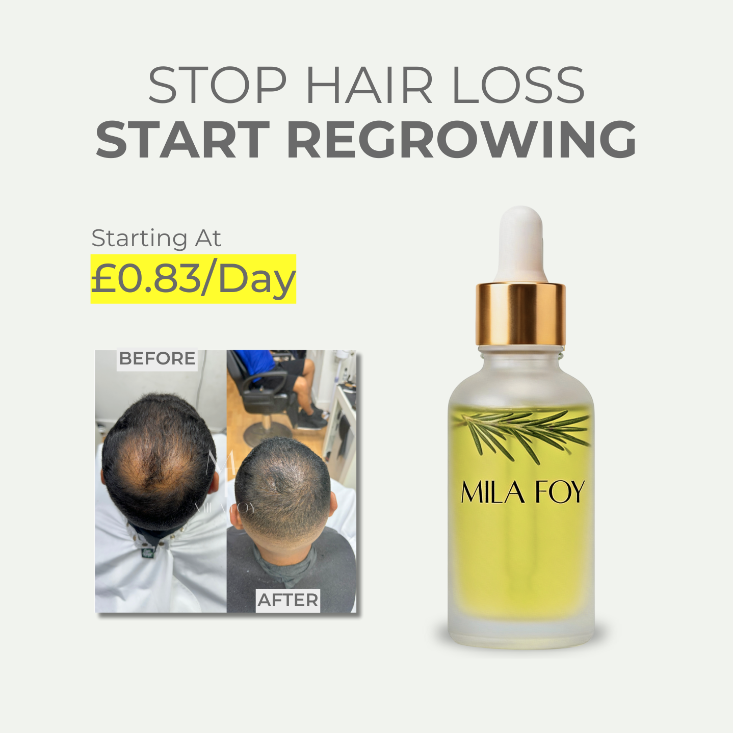 Hair Follicle Stimulator™ - Mila Foy