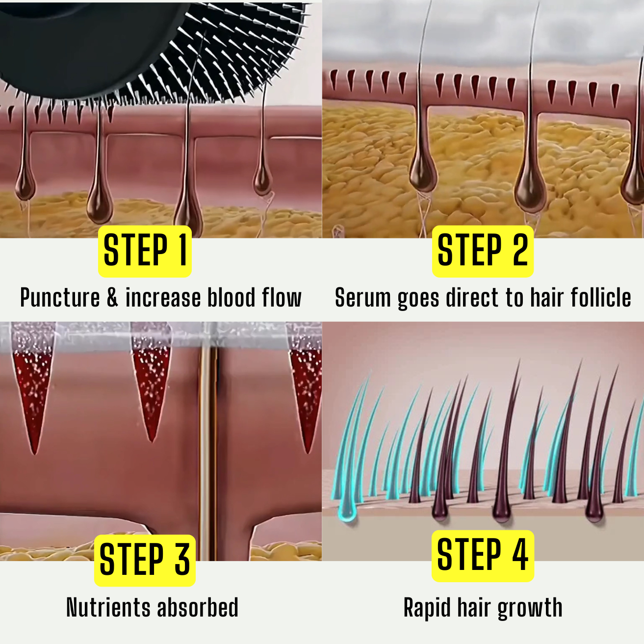 Miracle Roller™ (Rapid Hair Growth)